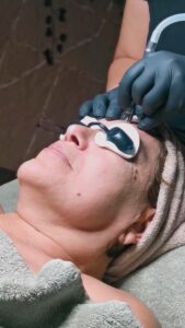 inDIVIDUALE MDA Microdermabradion