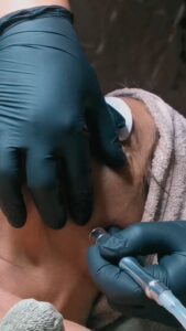inDIVIDUALE MDA Microdermabradion
