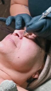 inDIVIDUALE MDA Microdermabradion