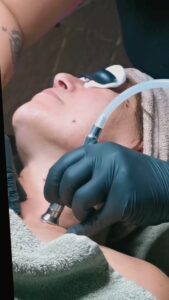 inDIVIDUALE MDA Microdermabradion